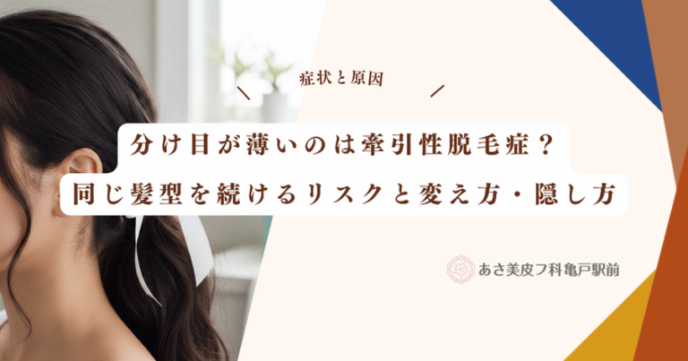 分け目が薄いのは牽引性脱毛症？同じ髪型を続けるリスクと変え方・隠し方