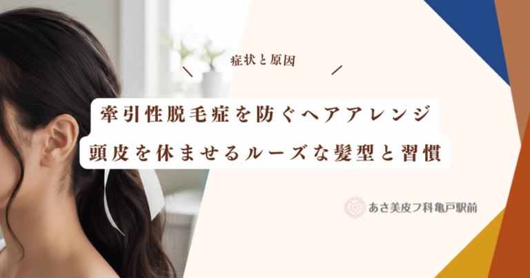 牽引性脱毛症を防ぐヘアアレンジ｜頭皮を休ませるルーズな髪型と習慣