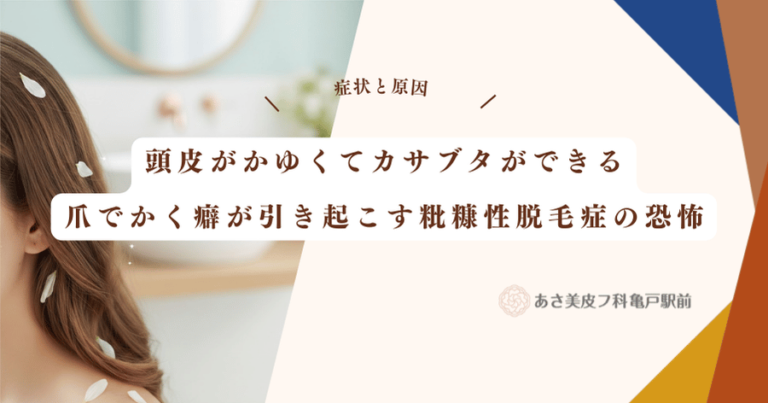 頭皮がかゆくてカサブタができる｜爪でかく癖が引き起こす粃糠性脱毛症の恐怖