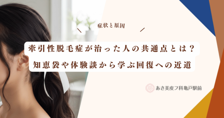 牽引性脱毛症が治った人の共通点とは？知恵袋や体験談から学ぶ回復への近道
