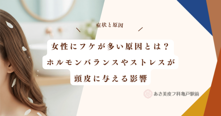 女性にフケが多い原因とは？ホルモンバランスやストレスが頭皮に与える影響