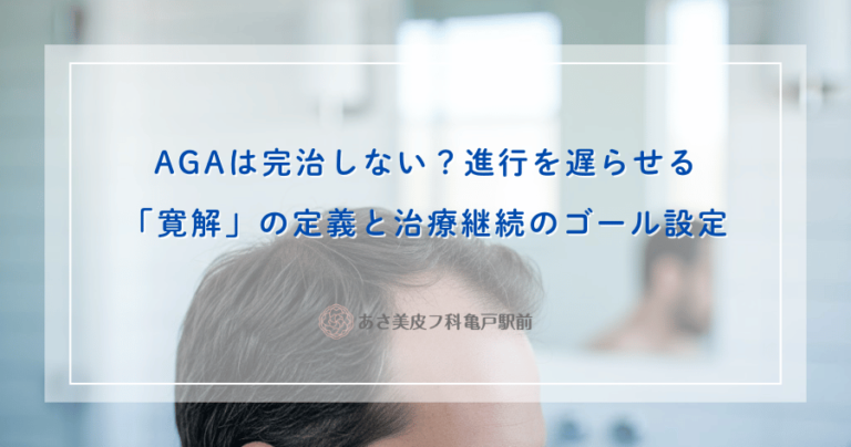 AGAは完治しない？進行を遅らせる「寛解」の定義と治療継続のゴール設定