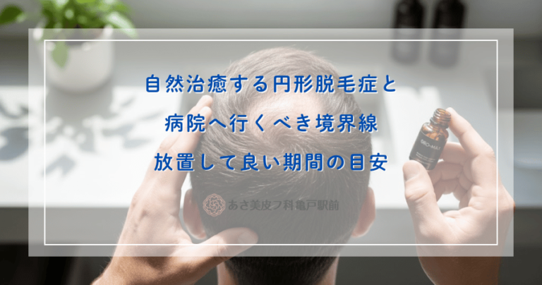 自然治癒する円形脱毛症と病院へ行くべき境界線｜放置して良い期間の目安