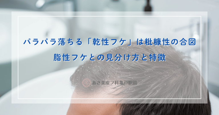 パラパラ落ちる「乾性フケ」は粃糠性の合図｜脂性フケとの見分け方と特徴