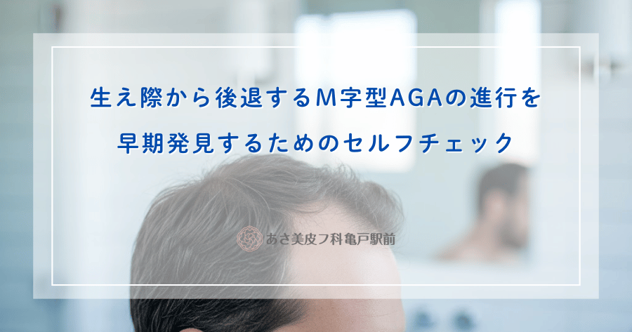 【M字ハゲ診断】生え際後退の初期症状を見抜く！正確なセルフチェック法と対策