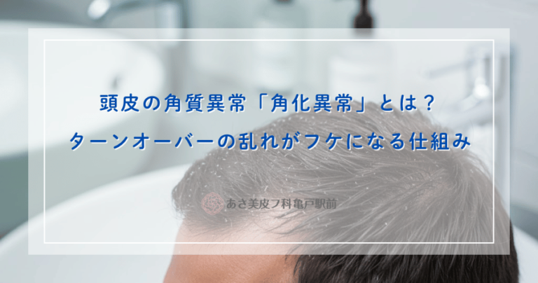 頭皮の角質異常「角化異常」とは？ターンオーバーの乱れがフケになる仕組み