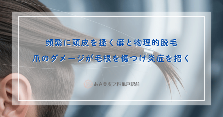頻繁に頭皮を掻く癖と物理的脱毛｜爪のダメージが毛根を傷つけ炎症を招く