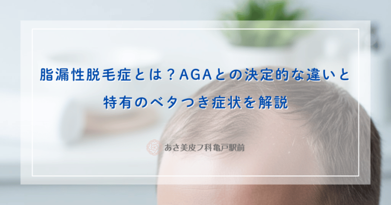 脂漏性脱毛症とは？AGAとの決定的な違いと特有のベタつき症状を解説
