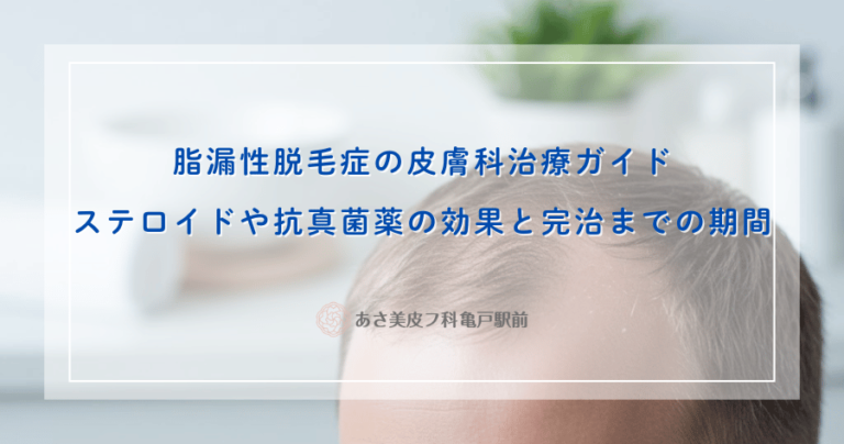 脂漏性脱毛症の皮膚科治療ガイド｜ステロイドや抗真菌薬の効果と完治までの期間