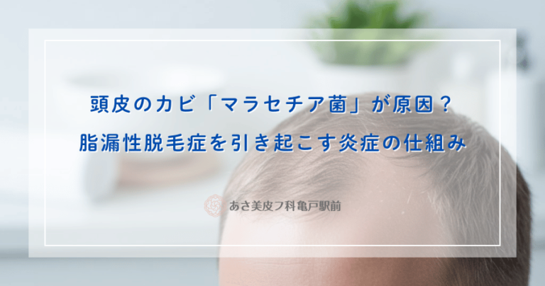 頭皮のカビ「マラセチア菌」が原因？脂漏性脱毛症を引き起こす炎症の仕組み