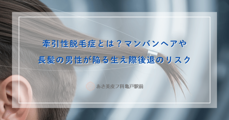牽引性脱毛症とは？マンバンヘアや長髪の男性が陥る生え際後退のリスク