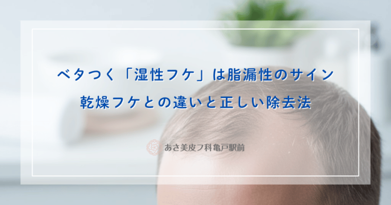 ベタつく「湿性フケ」は脂漏性のサイン｜乾燥フケとの違いと正しい除去法