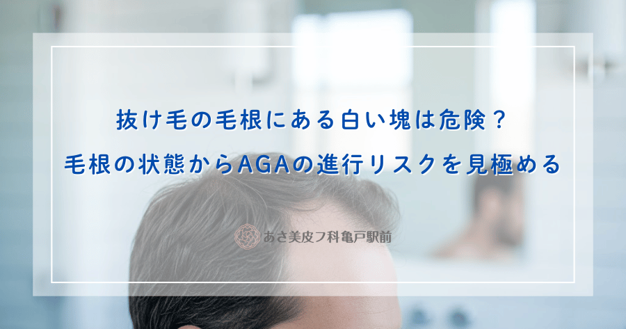 抜け毛の毛根にある白い塊は危険？毛根の状態からAGAの進行リスクを見極める