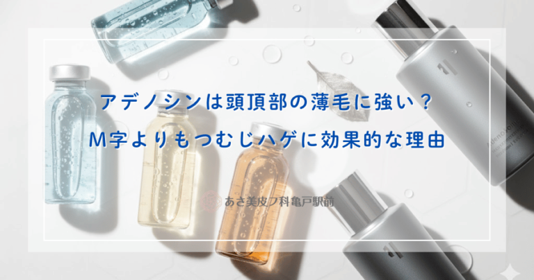 アデノシンは頭頂部の薄毛に強い？M字よりもつむじハゲに効果的な理由