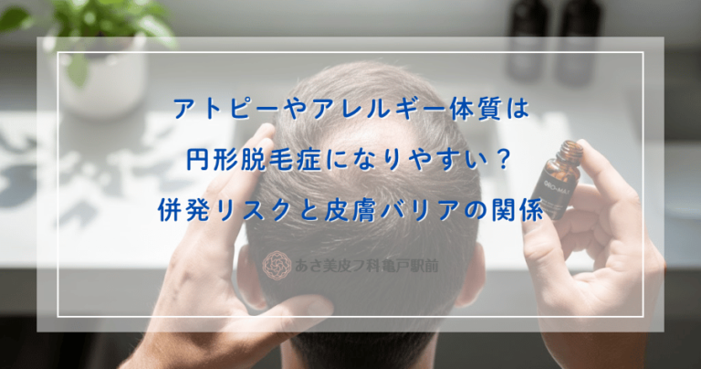 アトピーやアレルギー体質は円形脱毛症になりやすい？併発リスクと皮膚バリアの関係