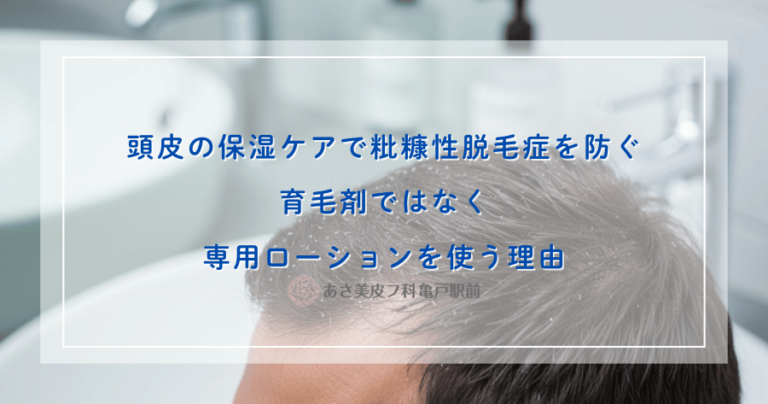 頭皮の保湿ケアで粃糠性脱毛症を防ぐ｜育毛剤ではなく専用ローションを使う理由