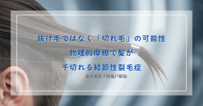 抜け毛ではなく「切れ毛」の可能性｜物理的摩擦で髪が千切れる結節性裂毛症