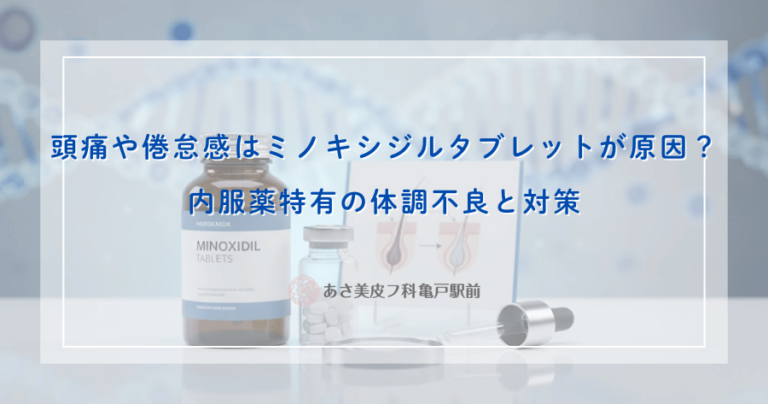 頭痛や倦怠感はミノキシジルタブレットが原因？内服薬特有の体調不良と対策