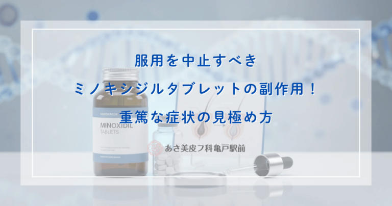 服用を中止すべきミノキシジルタブレットの副作用！重篤な症状の見極め方