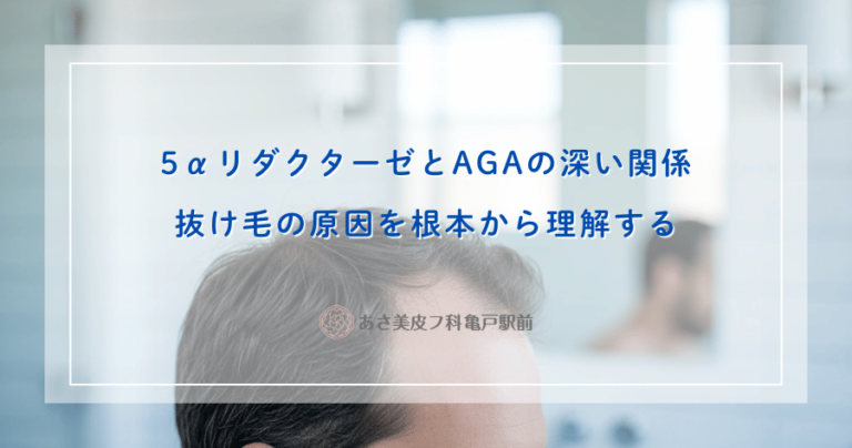 5αリダクターゼとAGAの深い関係｜抜け毛の原因を根本から理解する
