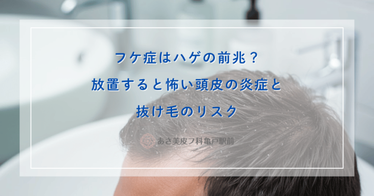 フケ症はハゲの前兆？放置すると怖い頭皮の炎症と抜け毛のリスク