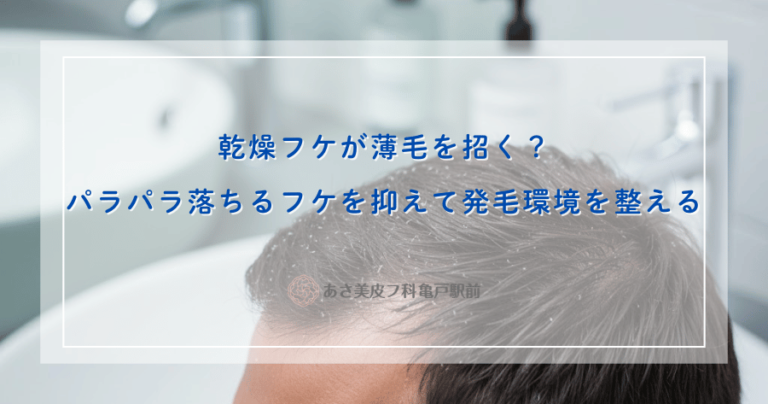 乾燥フケが薄毛を招く？パラパラ落ちるフケを抑えて発毛環境を整える