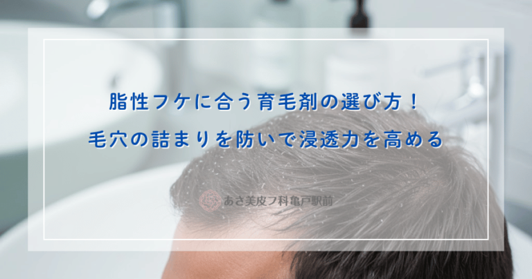 脂性フケに合う育毛剤の選び方！毛穴の詰まりを防いで浸透力を高める